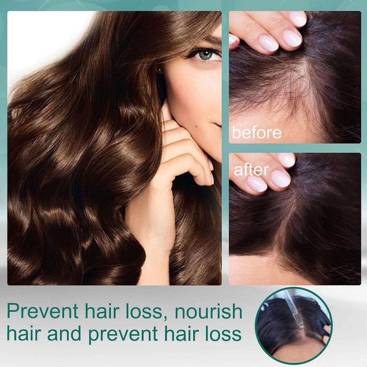 Natural Essence Ginger Hair Nutrition Solution 7* Rapid Growth 30ml (Pack of 2)